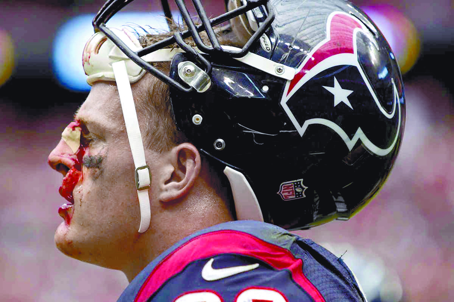 $!El enemigo número uno en la NFL: Las lesiones