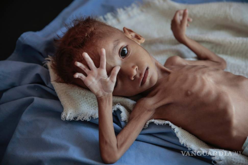 $!Según Save the Children, el hambre habría matado a 85 mil niños en Yemen