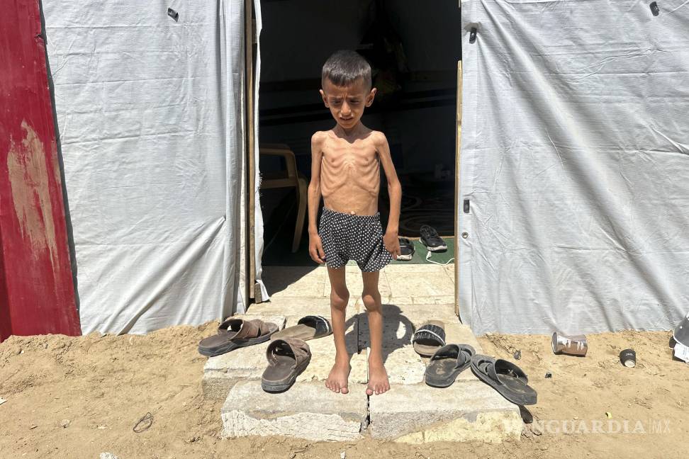 $!El niño gazatí Osama al Raqab, de 5 años, quiere jugar al fútbol o montar en bicicleta, pero la falta de energía no se lo permite.