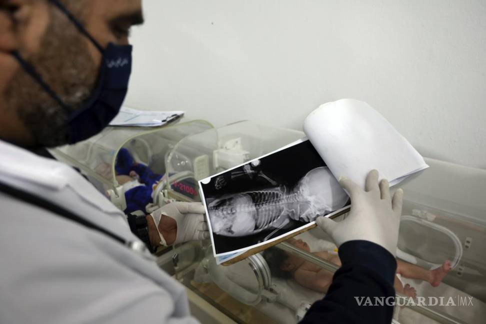 $!El doctor Hani Maarouf observa una radiografía de una niña que nació bajo los escombros causados por un terremoto que azotó a Siria y Turquía.