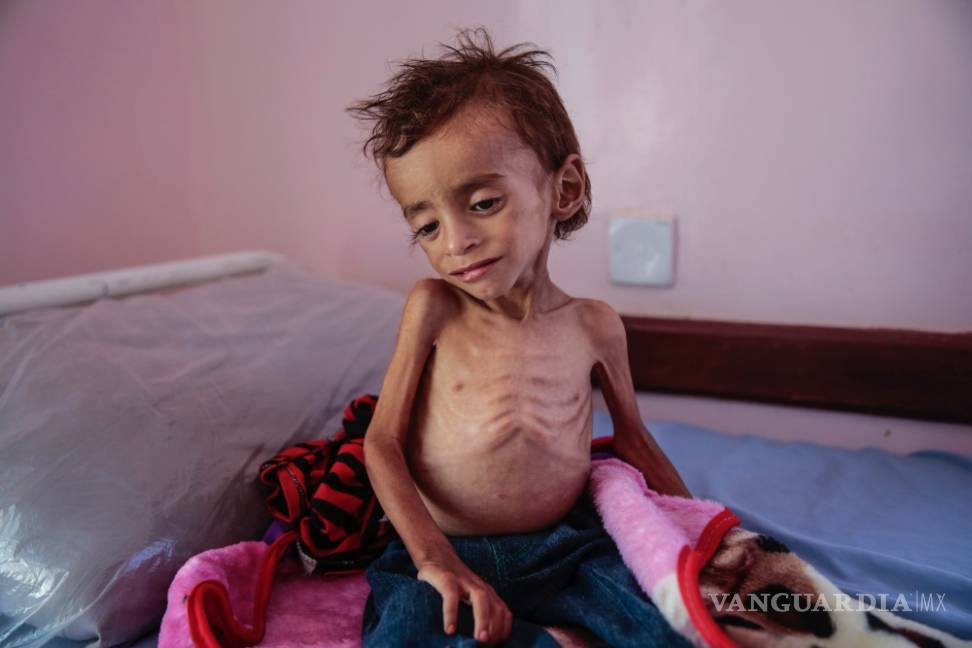$!Según Save the Children, el hambre habría matado a 85 mil niños en Yemen