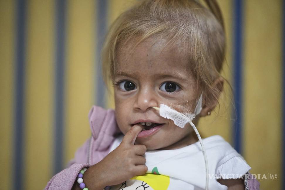 $!Shamm Qudeih sufría desnutrición desde que nació. Ahora pesa 5.5 kgs, que sigue siendo menos de la mitad del peso medio de una niña de su edad.