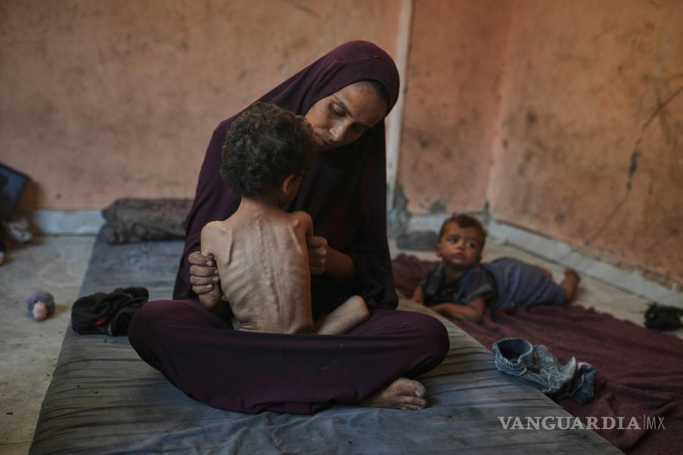 $!Naima Abu Ful con su hijo de 2 años, Yazan, que está desnutrido, en el campamento de refugiados de Shati en Ciudad de Gaza, el 23 de julio de 2025.