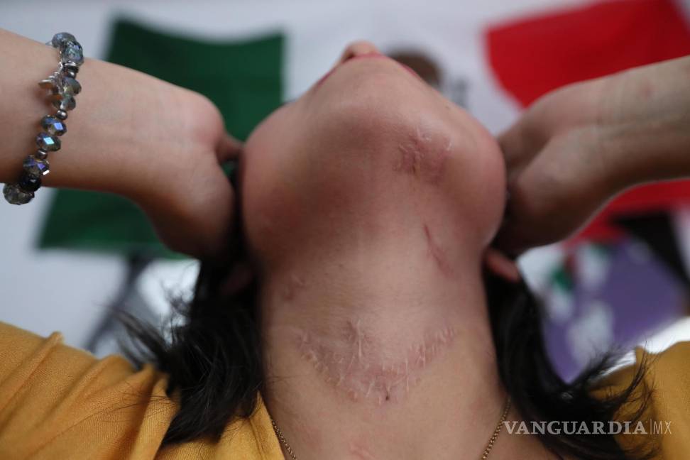 $!Ayyselet Gutiérrez fue víctima de intento de feminicidio. Su expareja le asestó 27 puñaladas que la llevaron a estar muy cerca de la muerte.