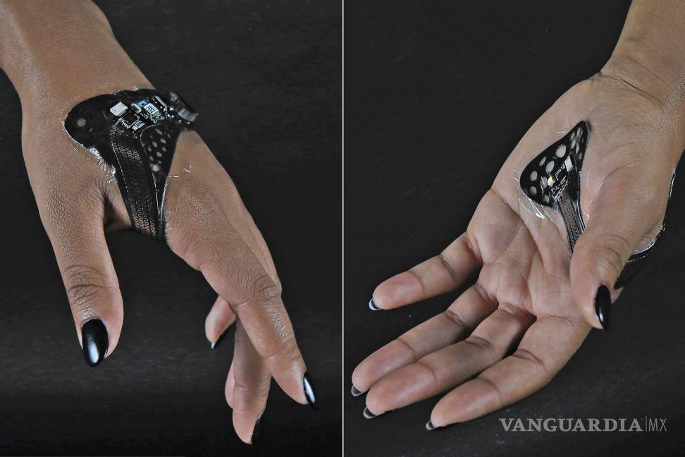 $!ElectroDermis, el revolucionario vendaje electrónico