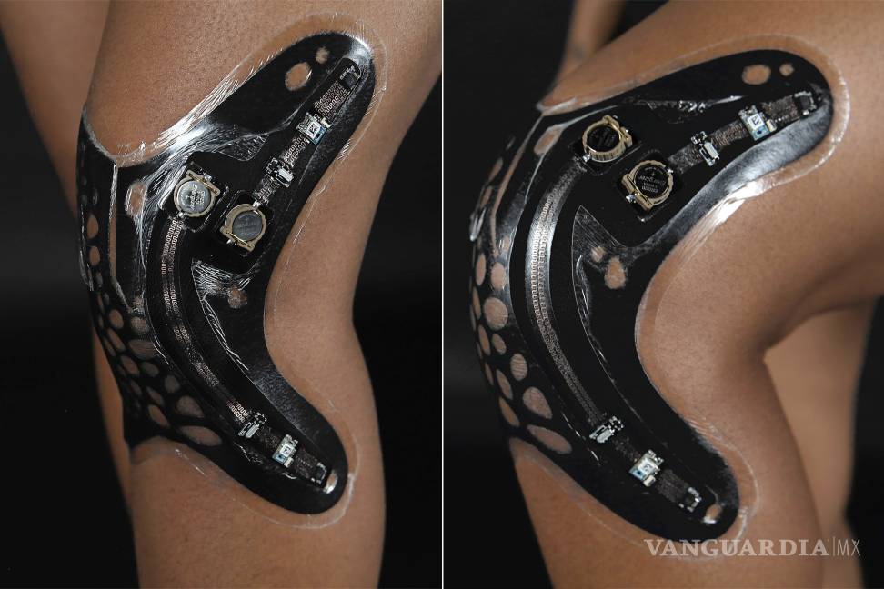 $!ElectroDermis, el revolucionario vendaje electrónico