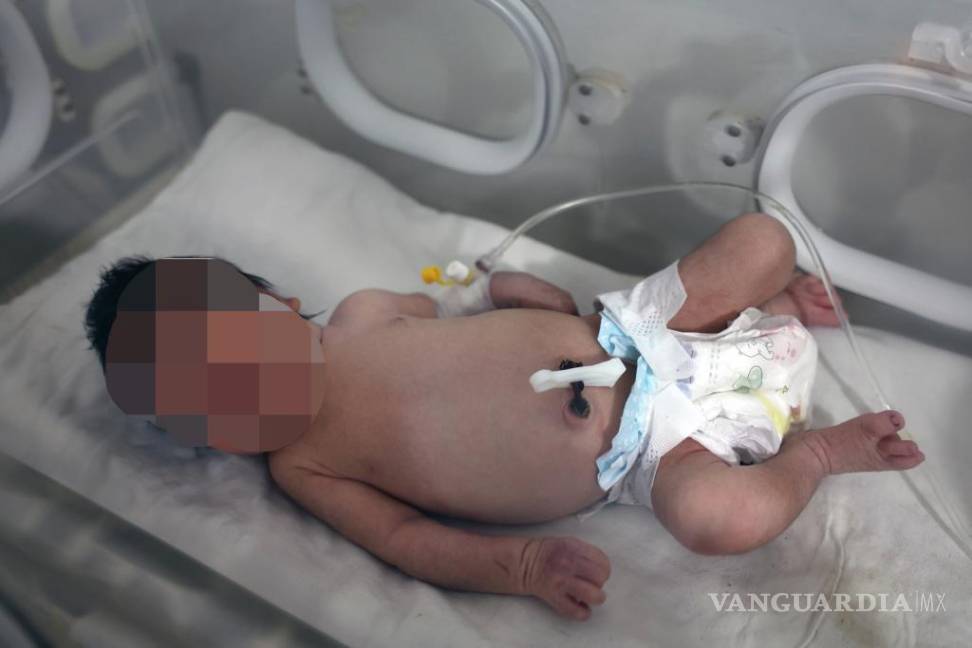 $!Una niña que nació bajo los escombros causados por un terremoto que azotó a Siria y Turquía recibe tratamiento en un hospital en Afrin, provincia de Alepo, Siria.