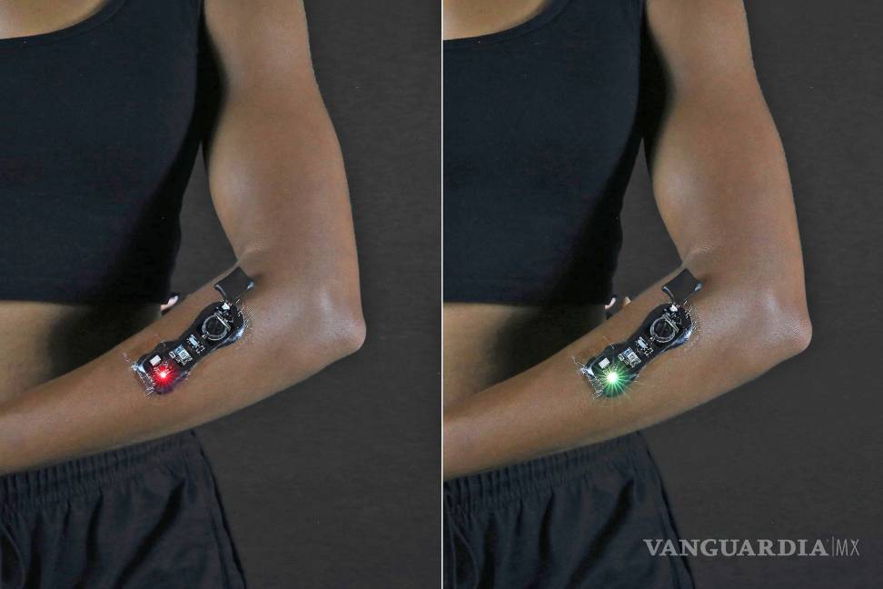 $!ElectroDermis, el revolucionario vendaje electrónico