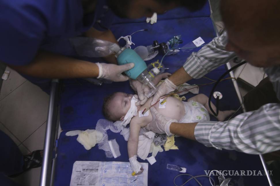 $!Un bebé palestino herido por bombardeos de Israel es atendido en el hospital de Al-Najar, en Rafah, Franja de Gaza.