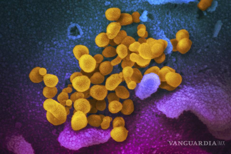$!Esta imagen coloreada de microscopio electrónico muestra el nuevo coronavirus SARS-CoV-2.