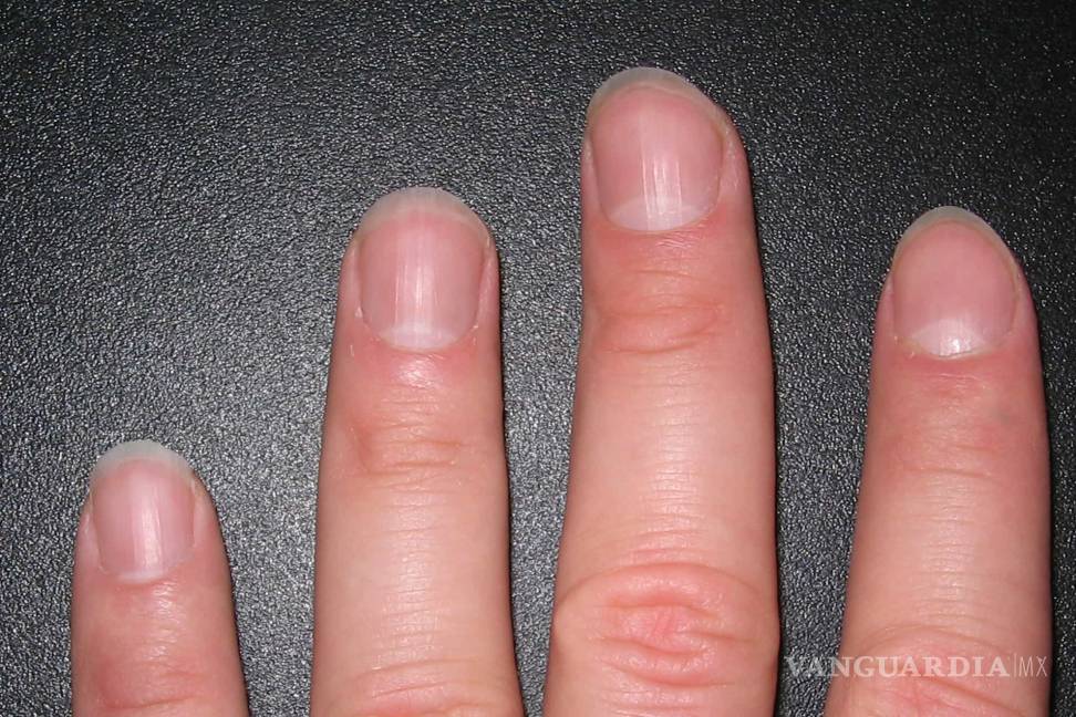 $!Los 7 problemas de uñas más frecuentes y cómo evitarlos