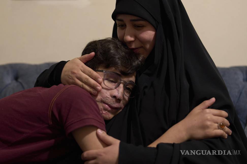 $!Hussein Dheini, de 12 años, herido en el ataque con bípers, recibe consuelo de su madre, Faten Haidar, en su casa en la aldea de Teir Debba, en el sur del Líbano.