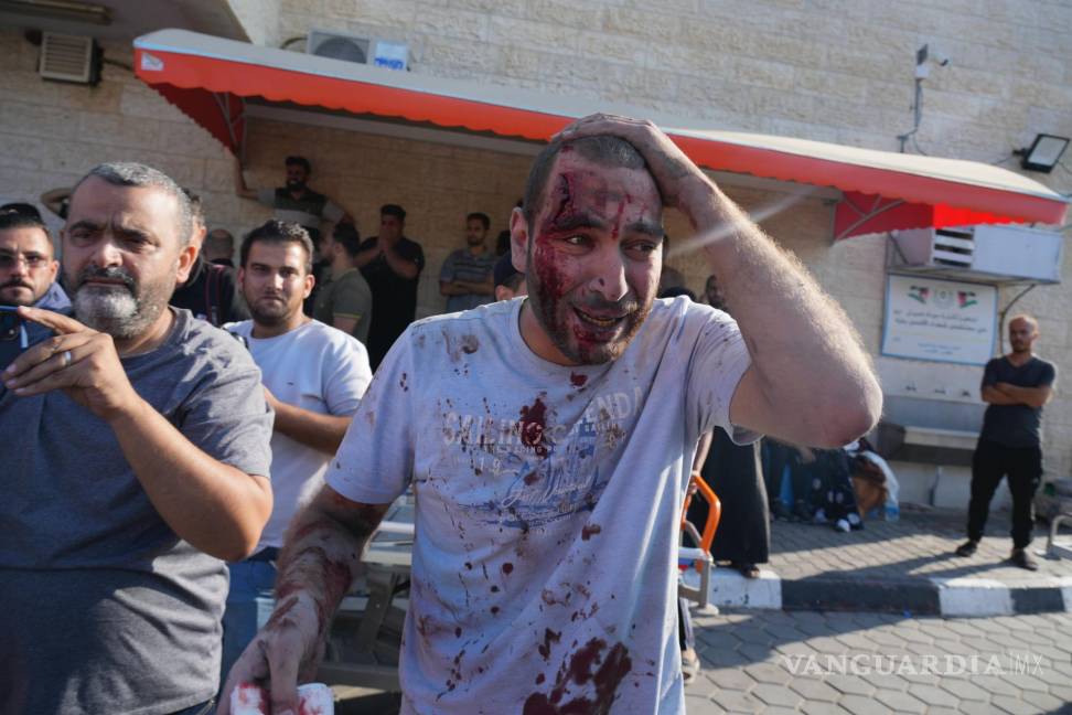 $!Un palestino herido en ataques aéreos israelíes llega al hospital de Al Aqsa en la ciudad de Der el-Balah, en la Franja de Gaza.