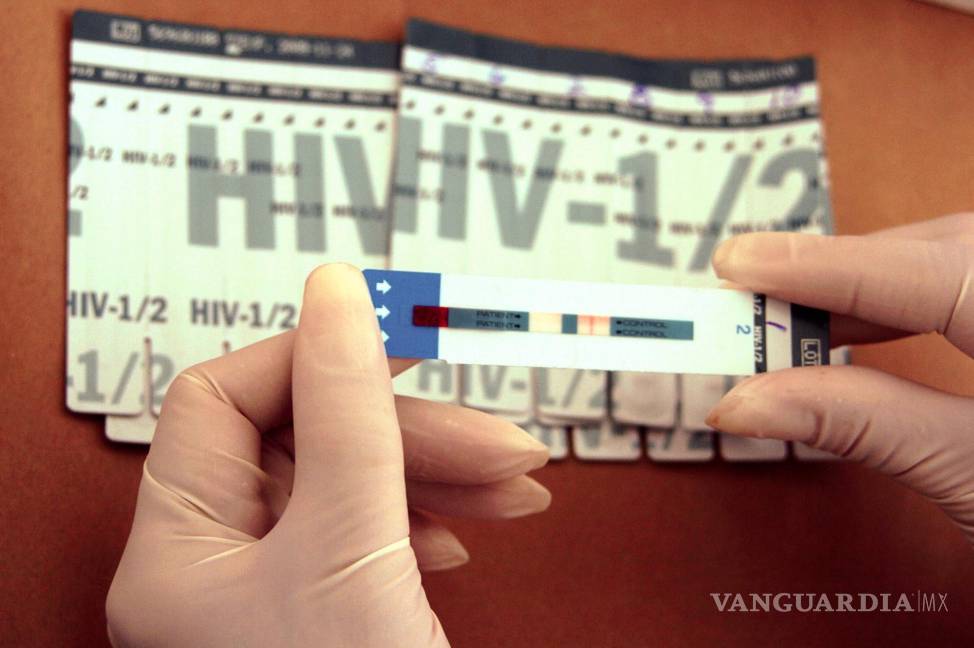 $!Un médico sostiene una prueba de detección del VIH hecha a una mujer durante una campaña sanitaria en Tegucigalpa (Honduras).