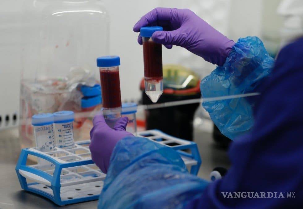 $!Descubren que existen diferencias en la sangre de pacientes graves y leves de COVID-19