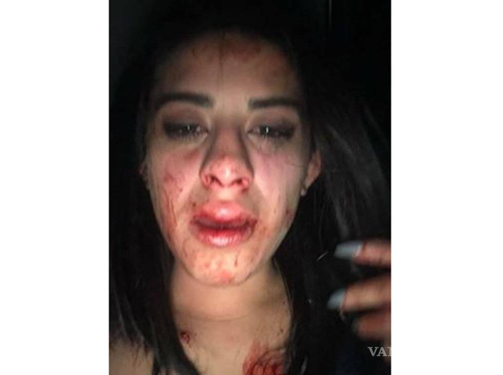 $!Ratifica Selene denuncia contra su novio agresor