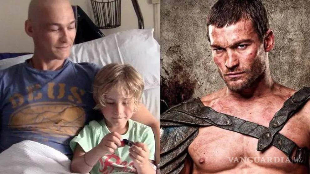 $!Andy Whitfield murió por Linfoma No Hodgkin en 2011 y en un documental se muestran sus últimos meses de vida, se llama “Be Here Now: The Andy Whitfield Story”.