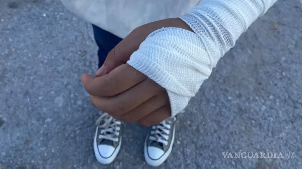 $!La joven sufrió cortadas en un brazo, golpes en la cabeza y otras partes del cuerpo, además de una lesión en la rodilla