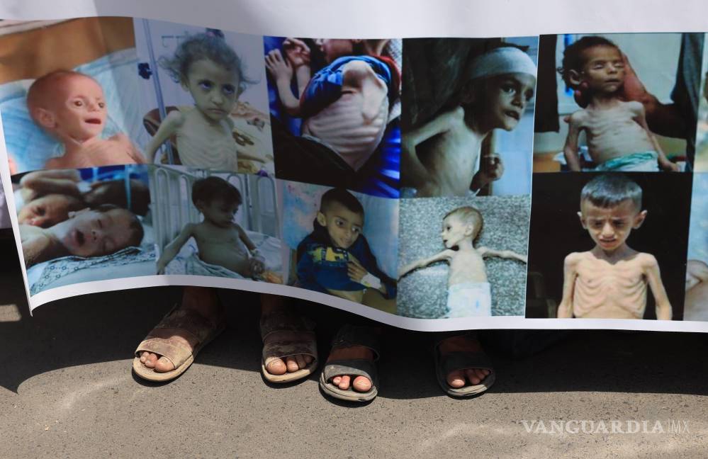 $!Manifestantes con una pancarta que muestra a niños palestinos con desnutrición severa durante una protesta para exigir el fin de la guerra en Gaza.