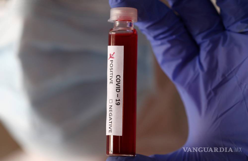 $!La peligrosa complicación en la sangre que está matando a pacientes con COVID-19