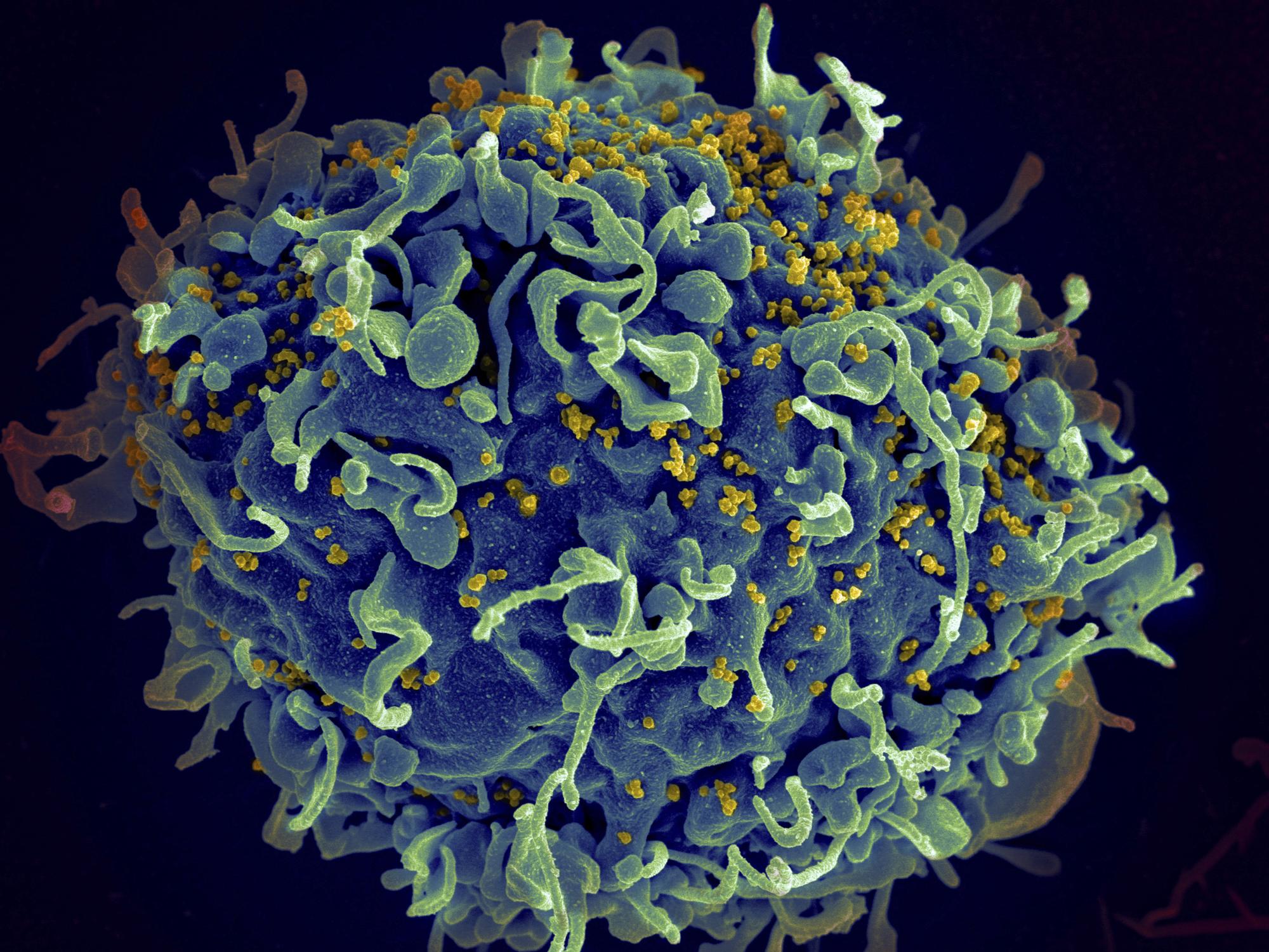 CDC identifica los tres primeros casos documentados de VIH por “faciales vampíricos” . Noticias en tiempo real