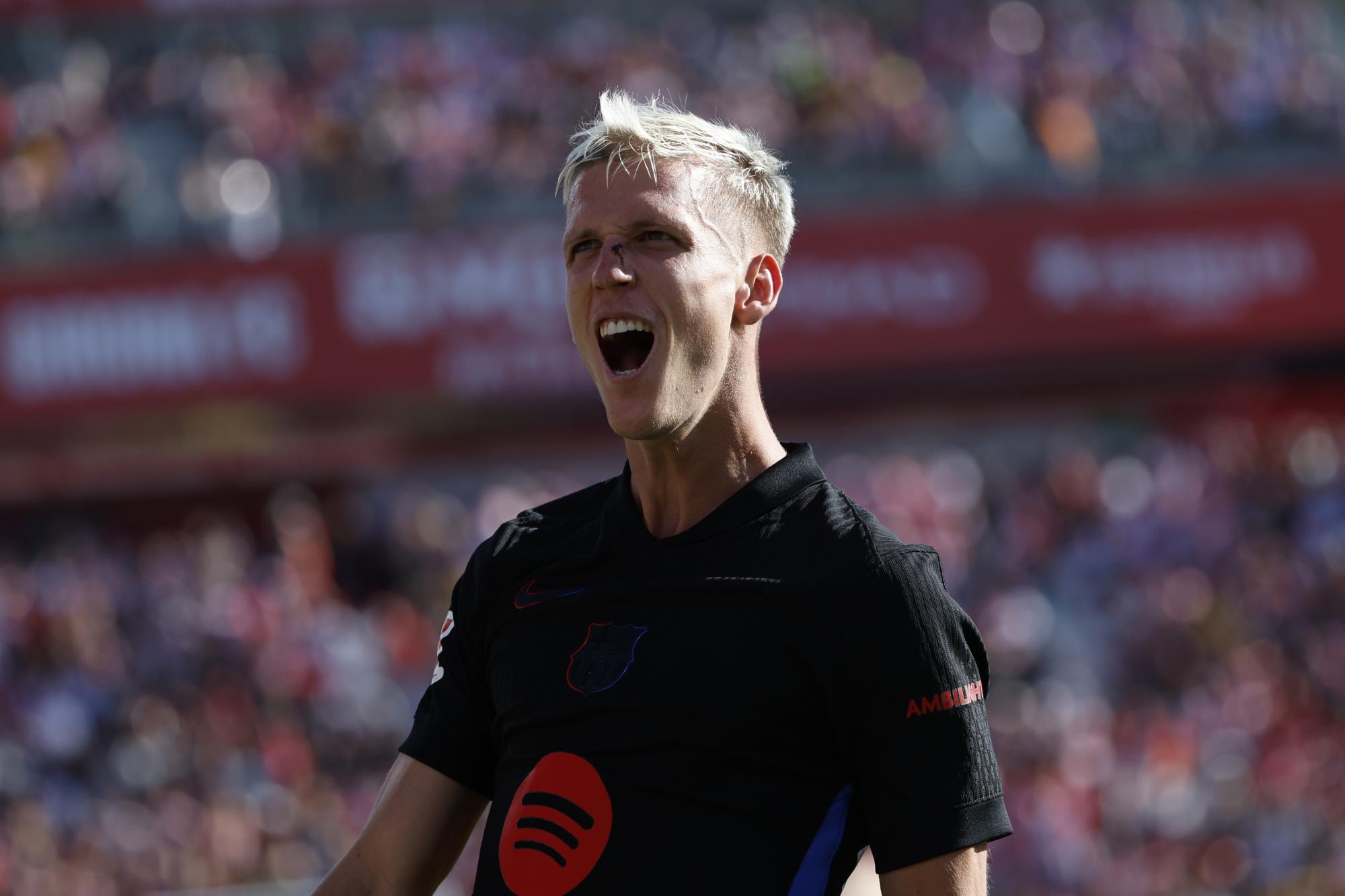 Barcelona sufre el golpe de la lesión de Dani Olmo tras su inicio ...
