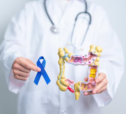 Coahuila: Cáncer colorrectal: crece letalidad y urge detección temprana