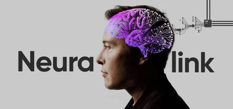 Probará Neuralink, empresa de Elon Musk, implantes cerebrales en humanos. Noticias en tiempo real