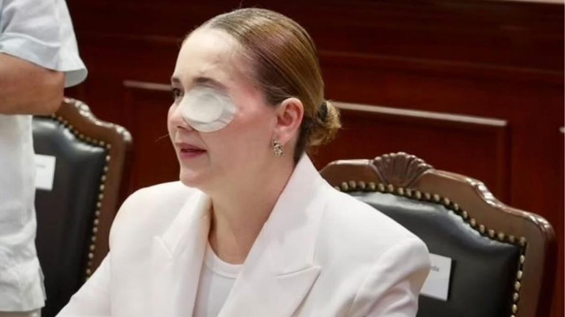 Elizabeth Montoya, diputada de MC que sufrió atendado, regresó al Congreso de Sinaloa