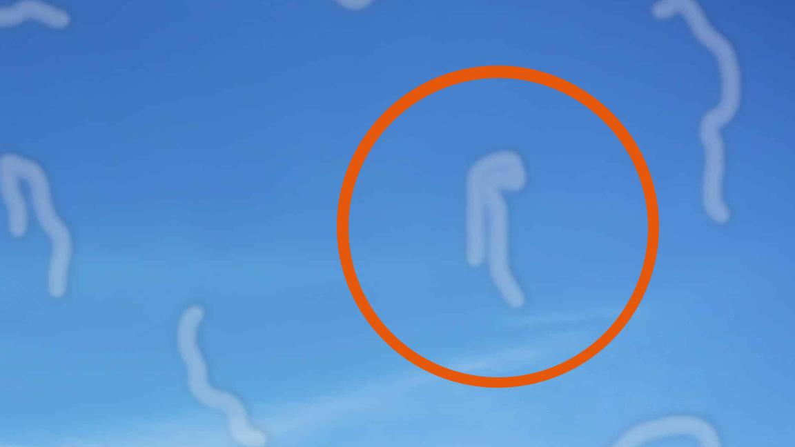 ¿Qué son las misteriosas manchas que veo en mis ojos al mira