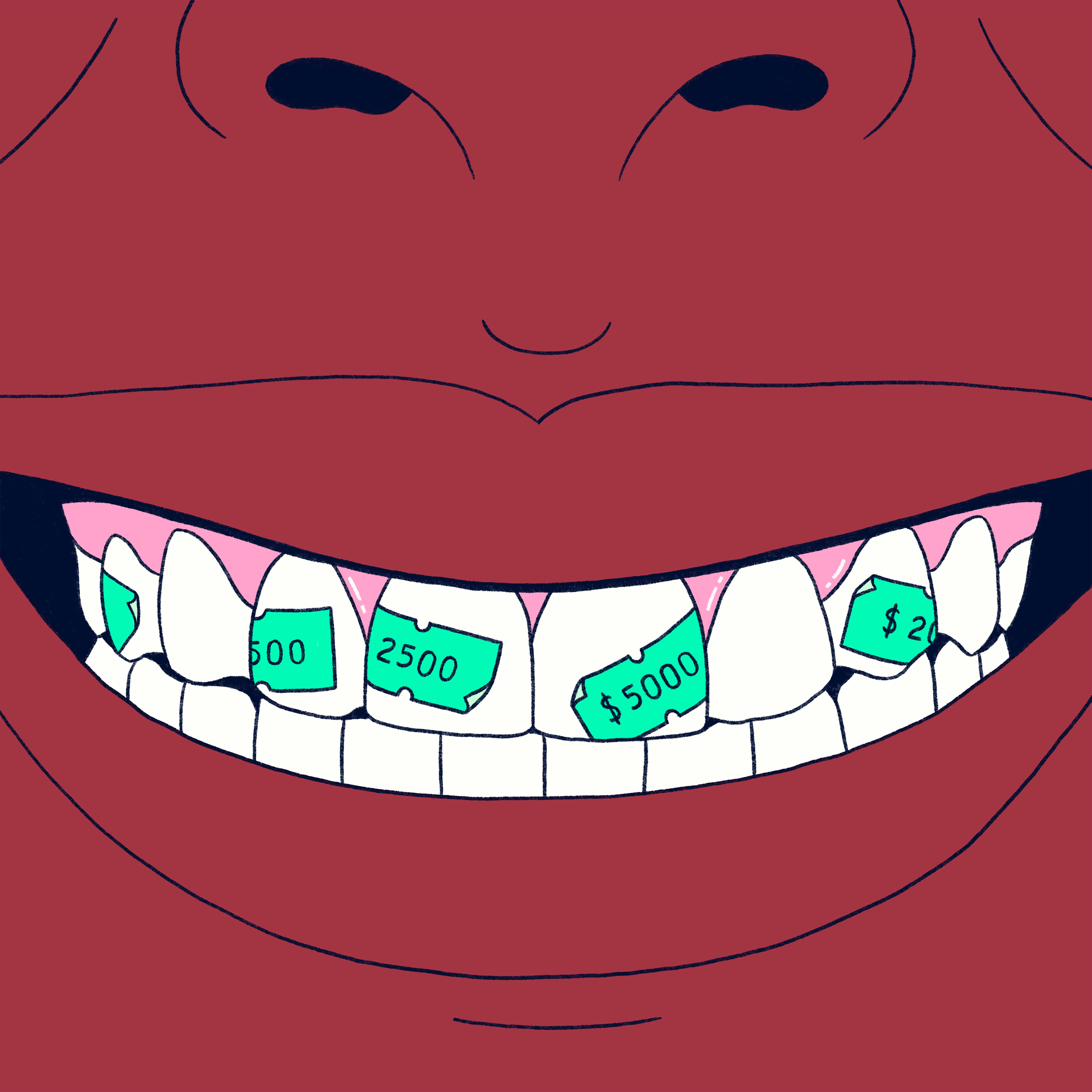Una caries no siempre necesita empaste
