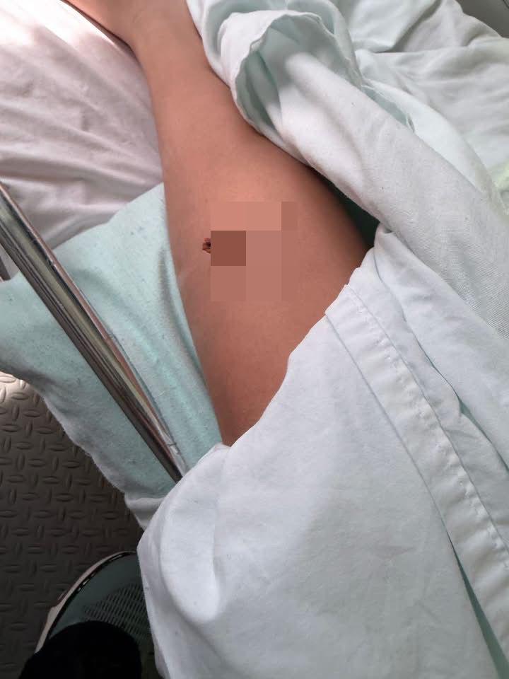 Terror y desesperación en primaria de Monclova; lápiz queda incrustado en la pierna de una alumna