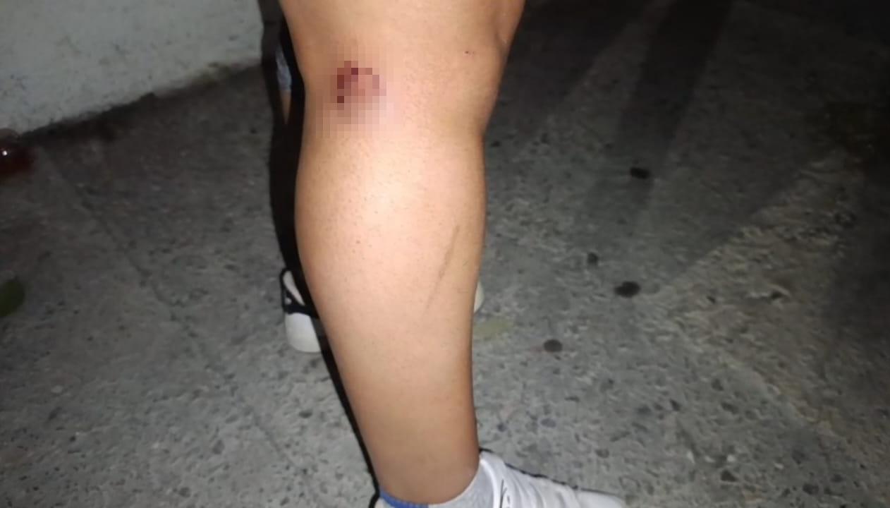 Ataca perro a mujer en Parras; vecinos denuncian reincidencia del animal